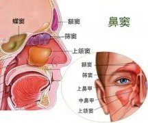 【全國(guó)愛(ài)鼻日】孩子出現(xiàn)這些癥狀，警惕鼻竇炎！